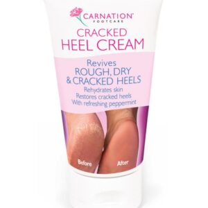 CARNATION CRACKED HEEL CREAM